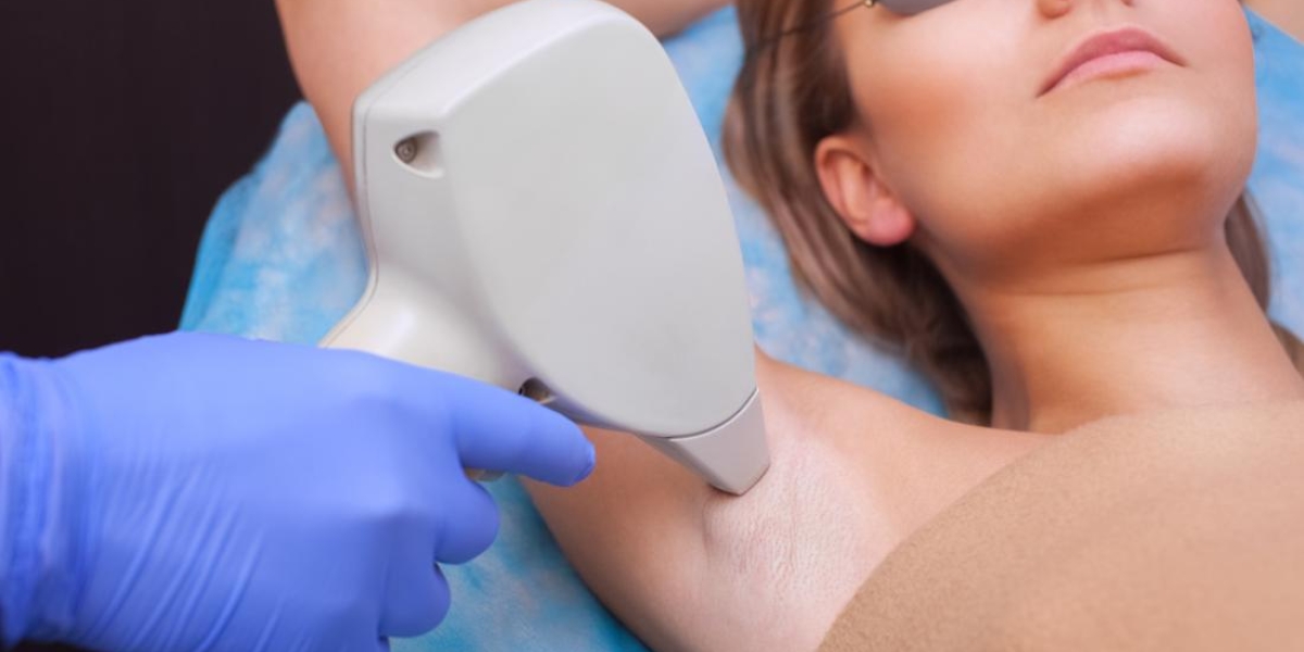 Armpits becoming sexy thanks to laser hair removal - MyFaceMyBody